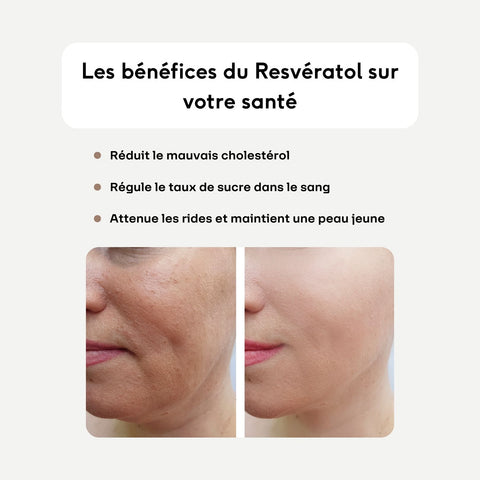 Resveratrol